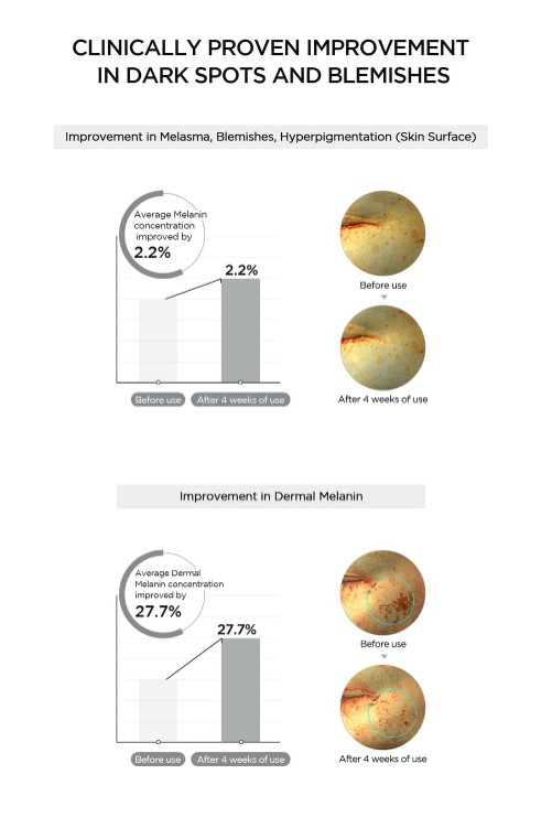 Skin1004 Madagascar Centella Tone Brightening Dark Spot Ampoule Pad - Image 5