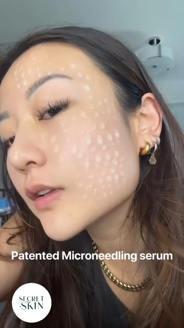 Achieve that glass skin with VT Cosmetics Reedle Shot can help contribute to the appearance of glass skin by improving skin texture and promoting a healthy, radiant complexion. It achieves this through microneedle technology that enhances product absorption and supports the skin’s natural renewal process.

#secretskin #koreanskincare #kbeautysouthafrica #glowingskin #glassskin
